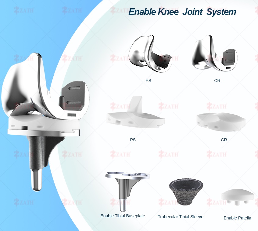 Knee Prosthesis
