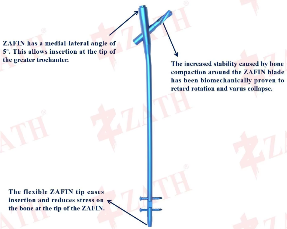 ZAFIN Nail